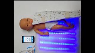 Biliblanket  use in tt of neonatal jaundice [upl. by Nitniuq952]