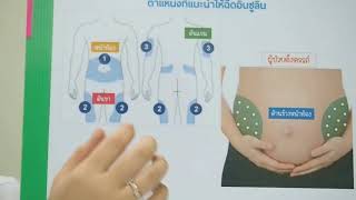 เทคนิคการใช้ปากกาอินซูลิน Lantus solostar [upl. by Fairfax]