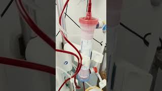 dialysistechnician hemodialysis use avf and 30minut before stope heparin [upl. by Wolff10]