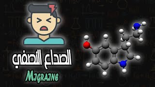 الصداع النصفي  Migraine [upl. by Tracee]