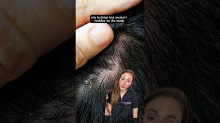 Get Rid Of Scalp Build Up [upl. by Atirys]