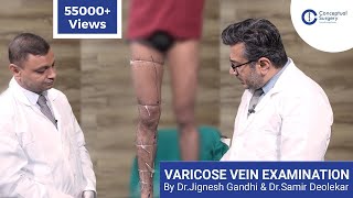 Varicose Vein Examination Dr Jignesh Gandhi and Dr Samir Deolekar [upl. by Lavotsirc]