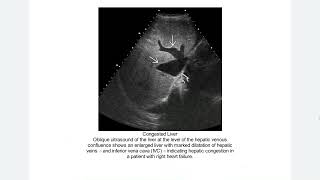 ABDOMEN PELVIS EXPERT DDX [upl. by Quill]