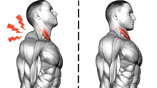 Fix Neck Pain Relief and Neck Hump [upl. by Ahsieyt185]