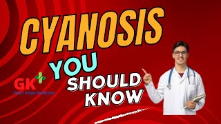 Cyanosis Kya Hai What is Cyanosis sapnajoshi5147 [upl. by Howie]