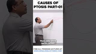 Causes Of Ptosis Part 01 drnajeeblectures drnajeeb shortvideo [upl. by Graehme]