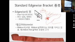 브라켓의 역사2 Standard Edgewise Technique이란 Straight wire Technique이란 [upl. by Amelus]