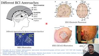 65 Recent Trends Microelectrode Arrays and Deep Brain Stimulation [upl. by Coulombe]