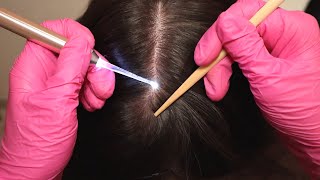 ASMR Doctor Exam amp Diagnostic for Itchy SCALP Infection Real Person [upl. by Yelnats]