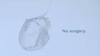 Allurion Intragastric Balloon [upl. by Elam]