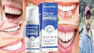 Smart Drops Teeth Whitening Foam Toothpaste  Honest Review [upl. by Ottillia]