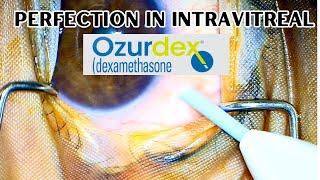 How to give intravitreal Ozurdex  Exercise right protocols from the beginning [upl. by Kalvn]