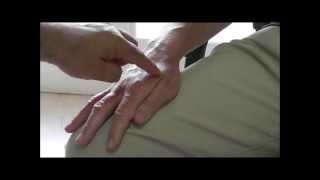 Using Acupuncture to treat Tennis Elbow Single session with effect in 24 hours [upl. by Olivann]