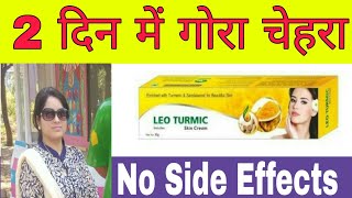 LEO TURMERIC skin cream review  Clear Glowing Fairness [upl. by Yazbak715]