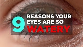 9 Reasons Your Eyes Are So Watery  Health [upl. by Ros]