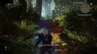 The Witcher 2 Walkthrough HD FR Part 19  Les contrats 2 lHôpital Psychiatrique [upl. by Haidabez]