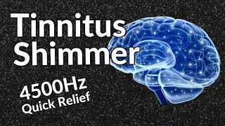 Tinnitus Shimmer  Sound Therapy Relief That WORKS [upl. by Adela]