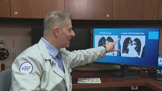 New procedure giving COPD patients hope relief [upl. by Yrtneg]