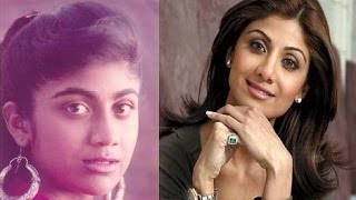 How Glutathione injection effects on Bollywood Actresses  from Black to White Skin [upl. by Beora109]