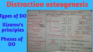 Distraction Osteogenesis partI [upl. by Ilehs]