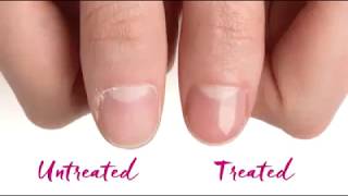 Dr Dana Nail renewal system [upl. by Noside]