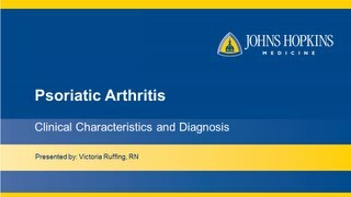 Psoriatic Arthritis  Clinical Characteristics and Diagnosis [upl. by Novat]