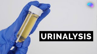 Urinalysis  Urine Dipstick Test  OSCE Guide  UKMLA  CPSA [upl. by Sioled]