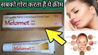 झाइयां जड़ से खत्म गोरा बेदाग चेहरा तुरंत देखो पूरी सच्चाई Melamet Cream review  SG Support [upl. by Nochur]