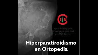 Hiperparatiroidismo en Ortopedia Dr Rubén Ordoñez U Libre [upl. by Tad574]