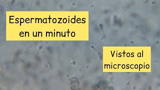 Espermatozoides al microscopio aumentados 400 veces [upl. by Llejk]