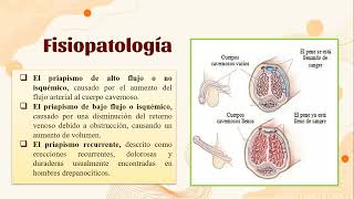 Priapismo [upl. by Wenoa]