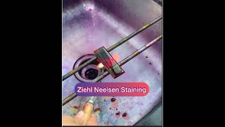 Ziehl Neelsen stainingZN stainingAFB staining Afb tb znstain [upl. by Ahmar236]