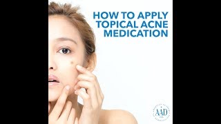 How to apply topical acne medication [upl. by Enirhtac]