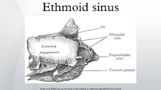 Ethmoid sinus [upl. by Benni]