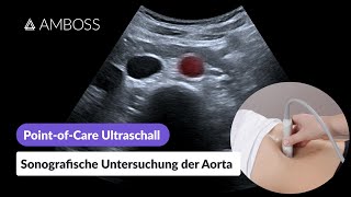 PointofCareUltraschall Teil 14 Sonografische Untersuchung der Aorta  AMBOSS [upl. by Atived761]