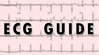 ECG Overview [upl. by Peale629]