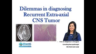 Recurrent Extraaxial CNS Tumor [upl. by Aloke]