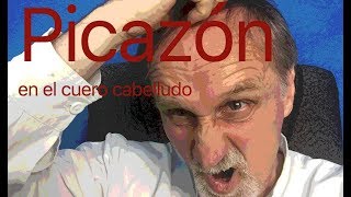 PICAZON en el cuero cabelludo [upl. by Elocon]