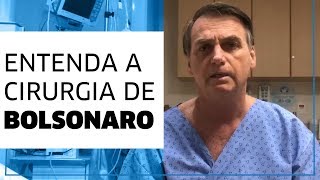 Entenda a cirurgia de Bolsonaro [upl. by Ittap245]