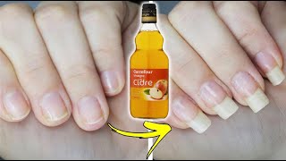 Astuce au vinaigre pour renforcer et faire pousser les ongles [upl. by Inilam]