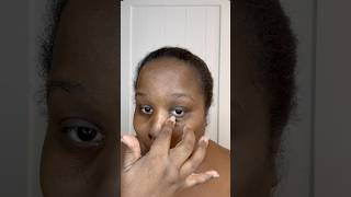 Get rid of hyperpigmentation skincare skincareroutine shorts skincareshorts skincareproducts [upl. by Llenart]