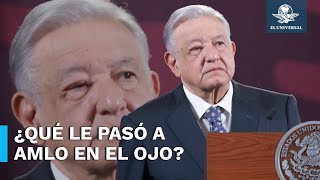 AMLO aparece con el ojo hinchado en La Mañanera esto dijo [upl. by Eladnor]