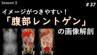 37 わかりやすい腹部レントゲンの画像解剖 [upl. by Yelrahc]