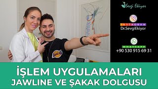 İşlem Uygulamaları  Jawline ve Şakak  Kemik Dolgu [upl. by Deevan]