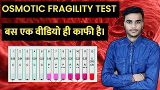 Osmotic Fragility Test  Osmotic Fragility Test In Hindi  What Is Oft  Medical Plus Point [upl. by Rowena]