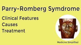 Parry Romberg Syndrome  Causes Symptoms Treatment and Clinical Features [upl. by Wessling]