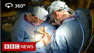 In 360 Oesophageal cancer operation filmed  BBC News [upl. by Lai]