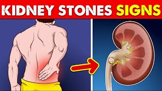 Warning signs of kidney stones [upl. by Nayek]