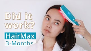 Did It Work HairMax Laser Comb 3 Month Update [upl. by Robbins505]