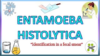 Entamoeba Histolytica  Morphology of the Trophozoite amp Cyst on Light Microscope Stools for AOC [upl. by Llereg]